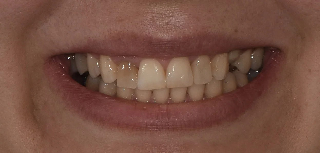 Before